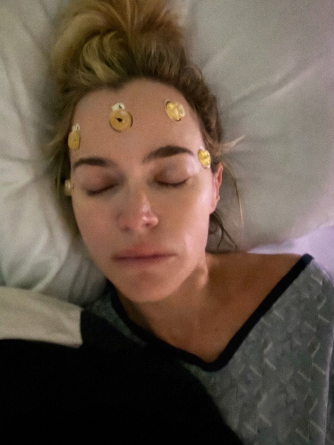 Teddi Mellencamp defends undergoing plastic surgery procedure during stage 4 cancer treatment