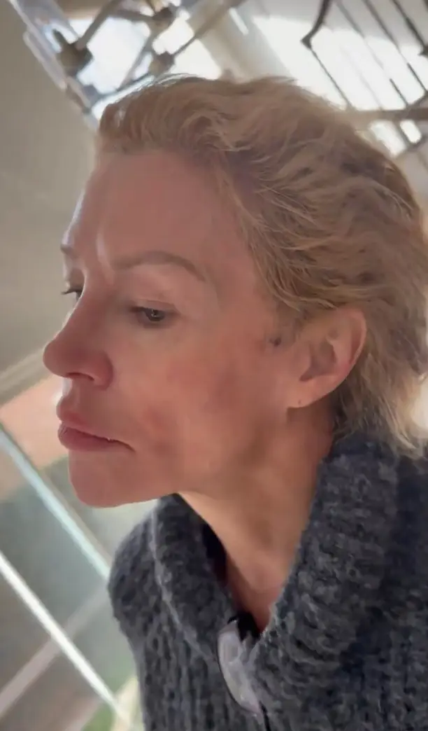 Brandi Glanville set to have 'face taken off' to 'power wash' under her skin after parasites emerge from breast implants