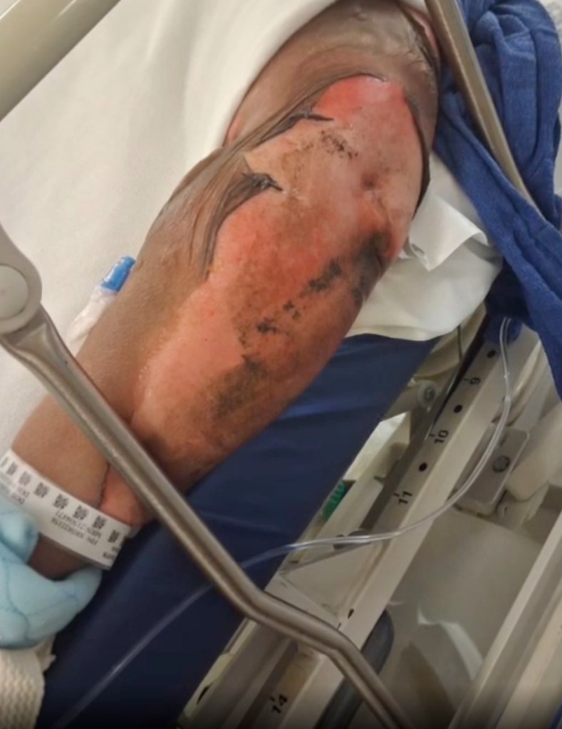 Family begs for justice after woman set on fire at California homeless camp dies