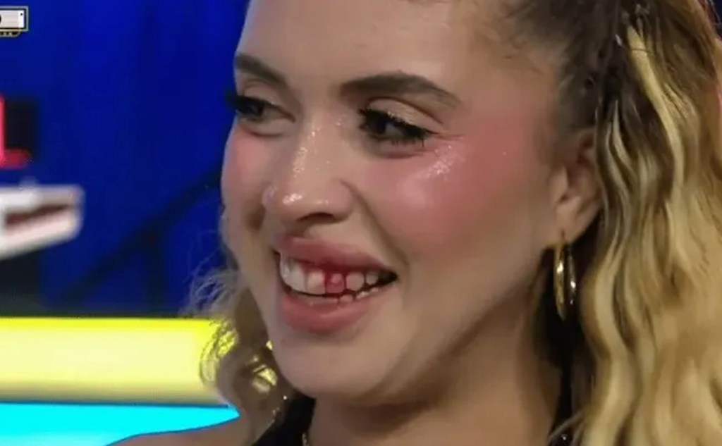 TV show host kicks drone into model’s face — blames mishap on his shoes