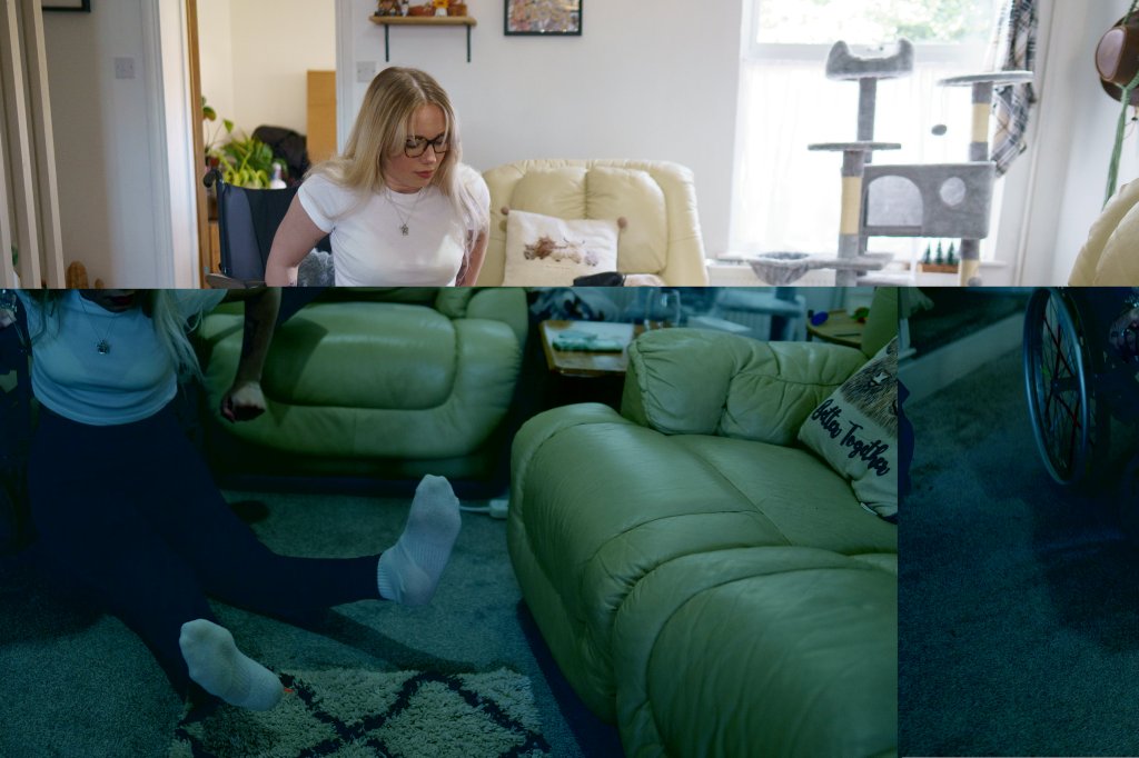 Woman plans to have legs amputated after legs locked straight, bent backwards