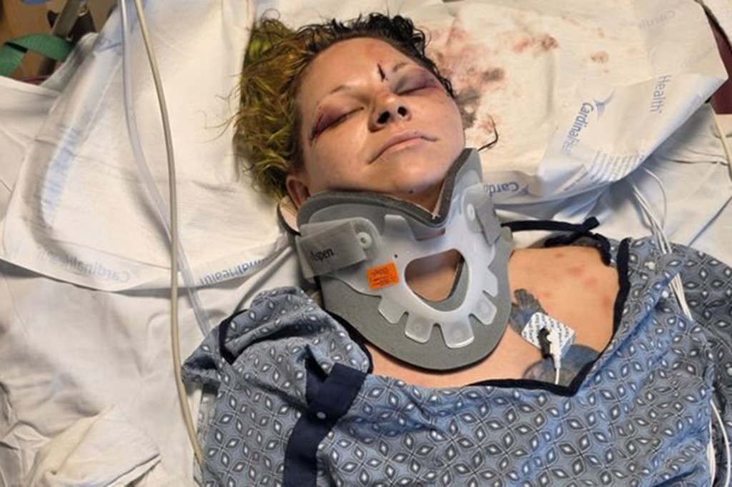 Bride-to-be stabbed in neck by fiancé just weeks before wedding