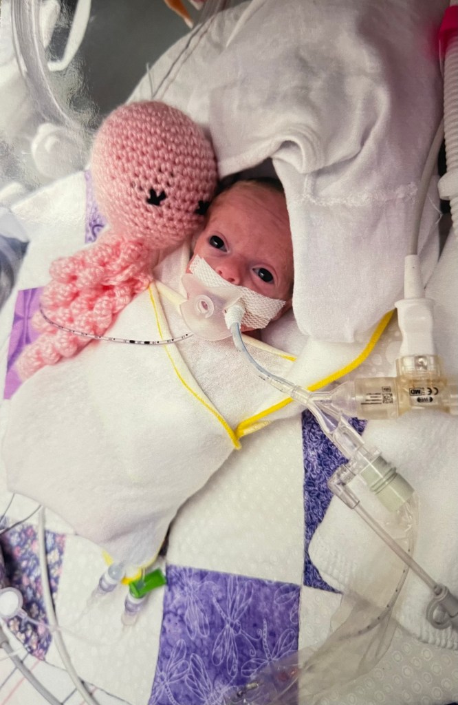 Premature twins separated at different Boston hospitals – as parents plead to reunite them before nurses’ strike