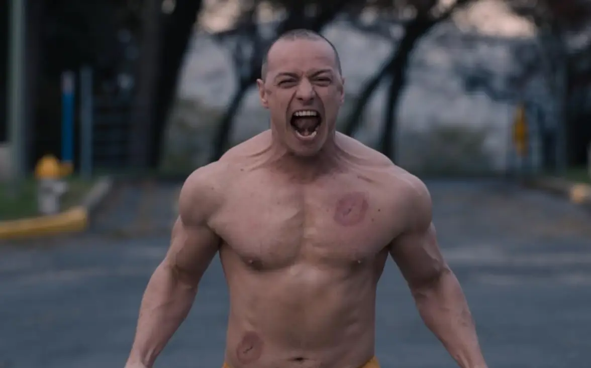 James McAvoy gets candid on the moment he 'nearly died' after life-saving medical procedure went wrong